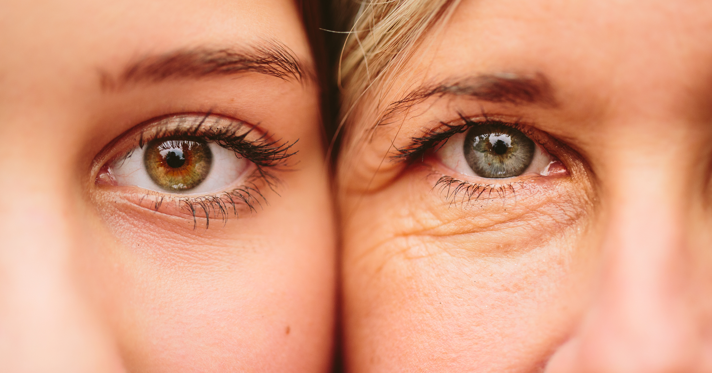 Trẻ hóa vùng mắt – bằng cách nào và khi nào là cần thiết?